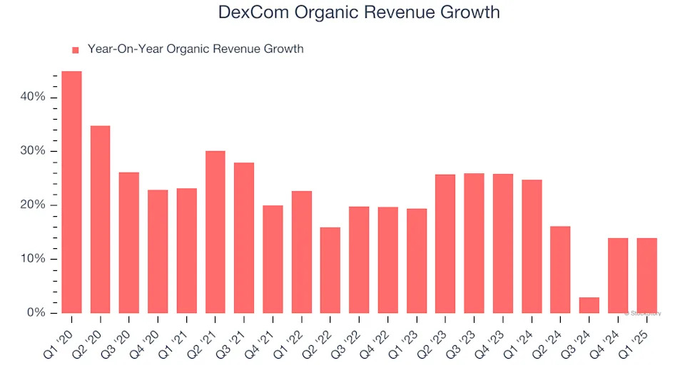 DexCom (NASDAQ:DXCM) Exceeds Q1 Expectations